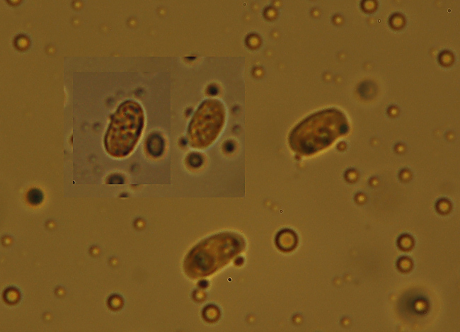 Crosta grigia su acero - foto 3034 (Scopuloides rimosa)